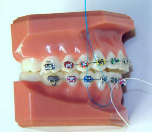 Floss-Threader.jpg