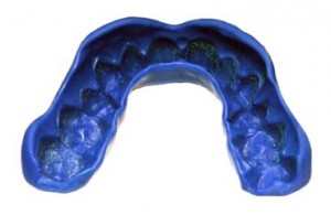 custom-mouthgaurd