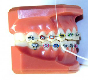 floss.jpg