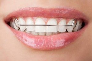 retainer 1
